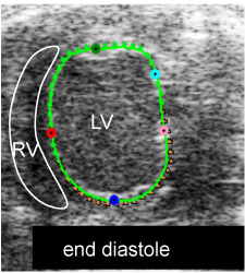 Figure 1 I