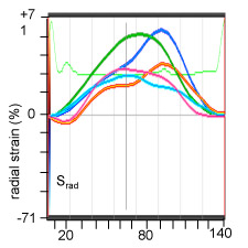 Figure 1 V