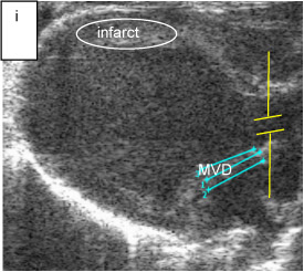 Figure 3 I