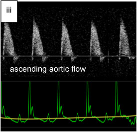 Figure 3 III