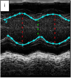 Figure 4 I