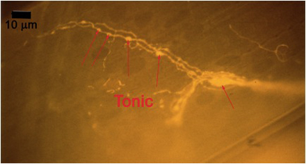 Figure 10B