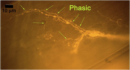 Figure 10C