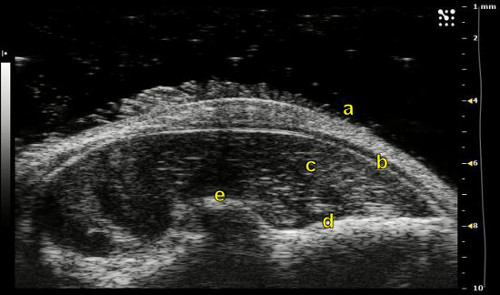 Figure 10