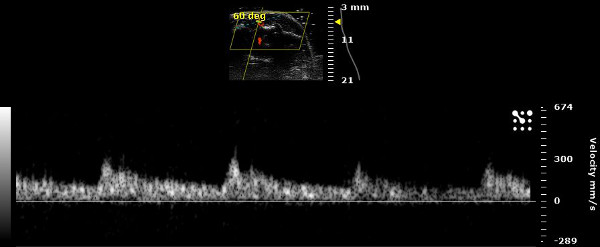 Figure 14