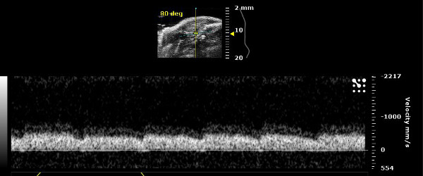 Figure 15