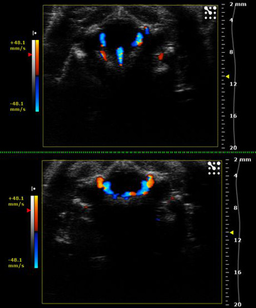 Figure 18