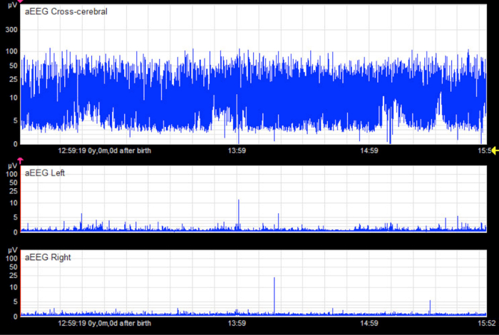 Figure 10