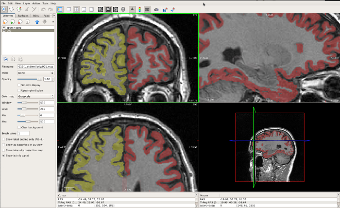 Figure 6