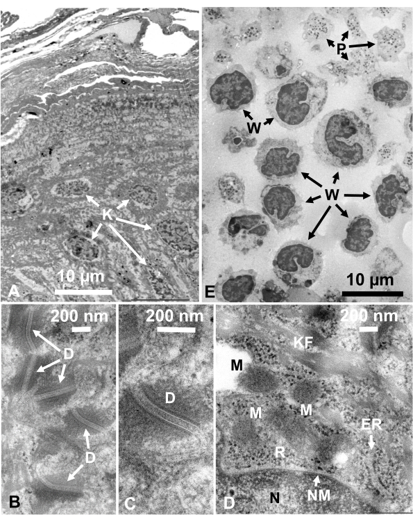 Figure 14